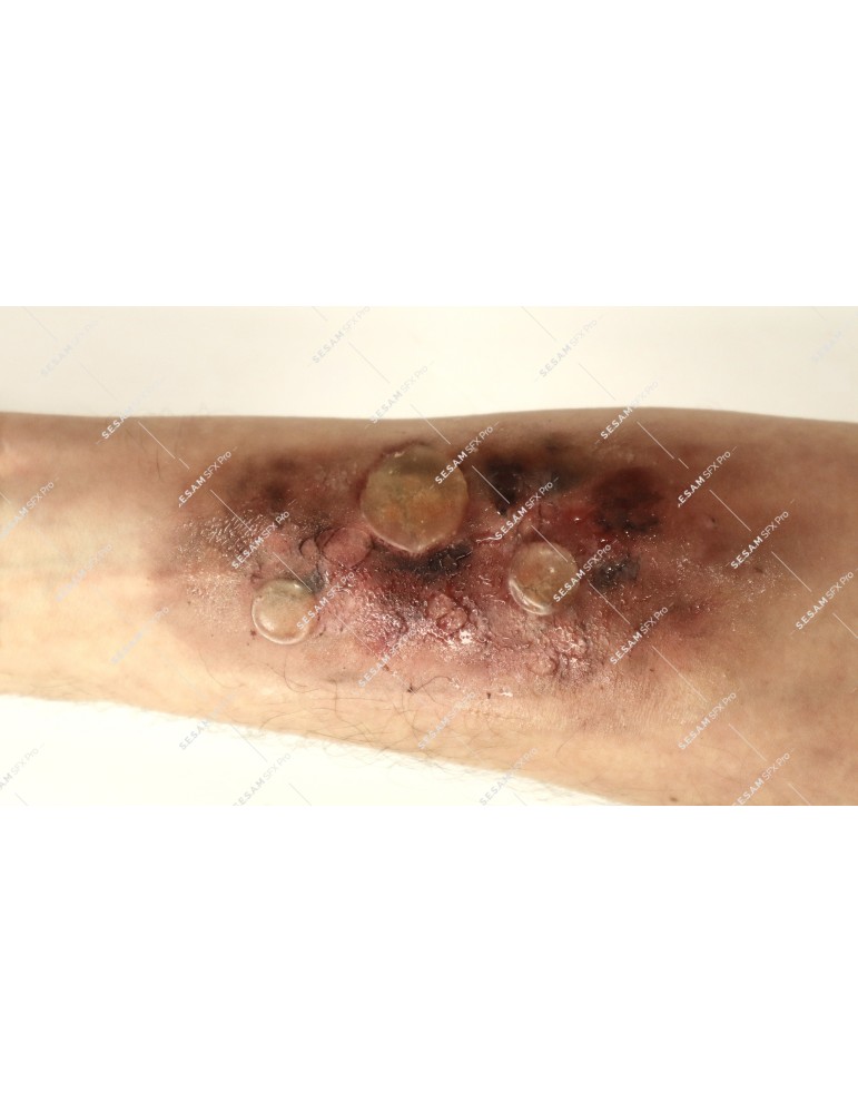 Phlyctenes reutilisables