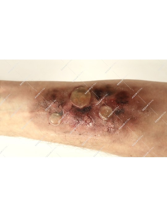 Trousse complète maquillage secourisme