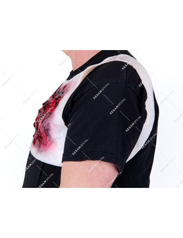 Brulure thermique thorax 2