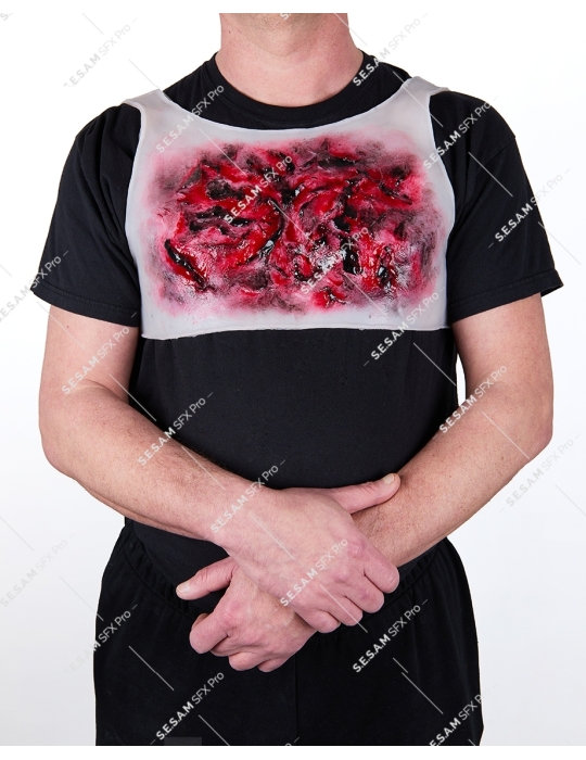 Brulure thermique thorax