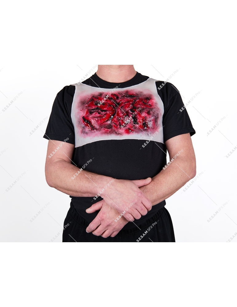 Brulure thermique thorax