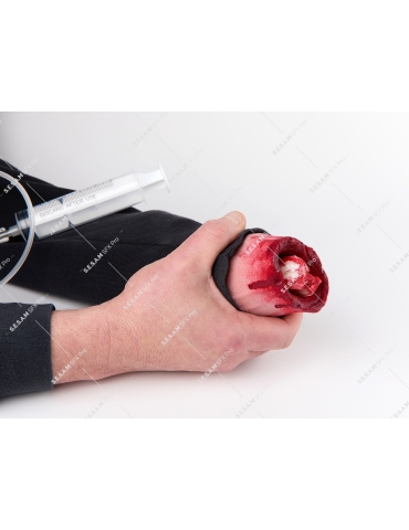 Plaie à garrotter 2