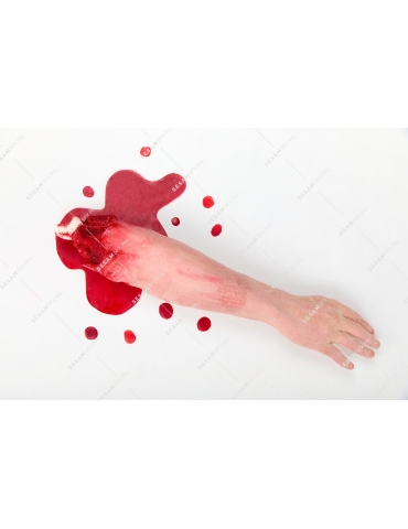 Avant bras arraché 2