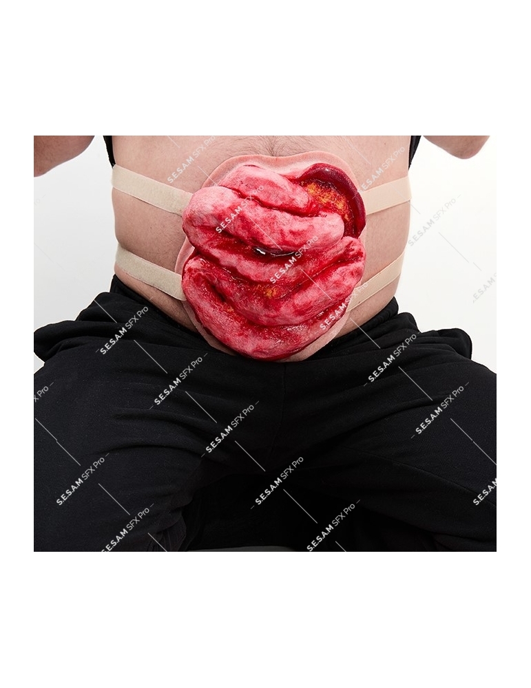 Eviscération