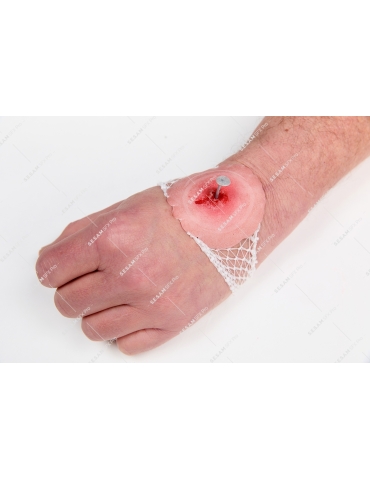 Plaie avec un clou sécurisé 2