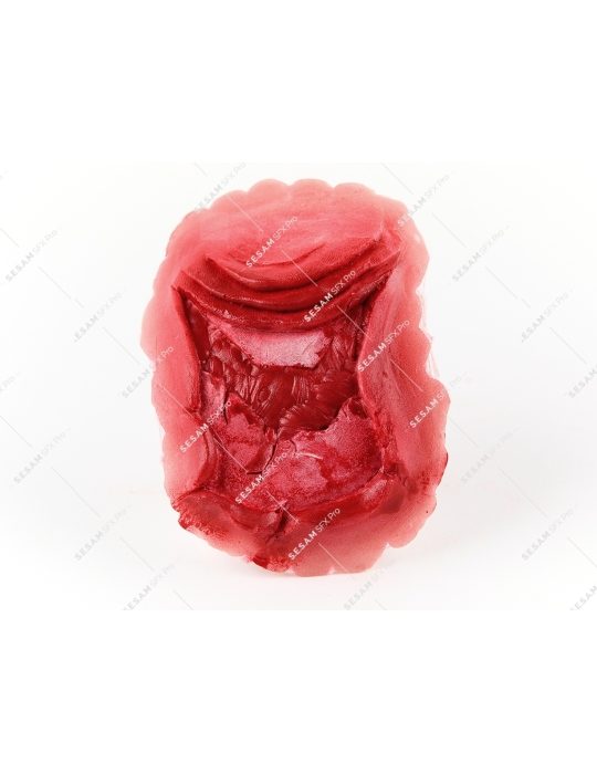 Fracture ouverte de la rotule