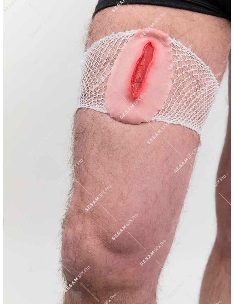 Plaie filet hémorragique