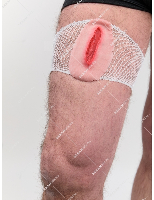 Plaie filet hémorragique