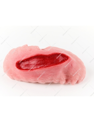 Plaie filet hémorragique