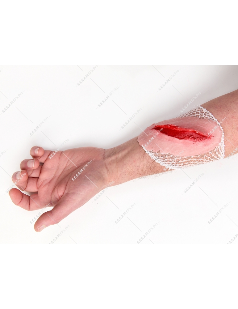 Plaie à bords irréguliers