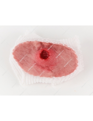 Plaie par balle 1 entrée