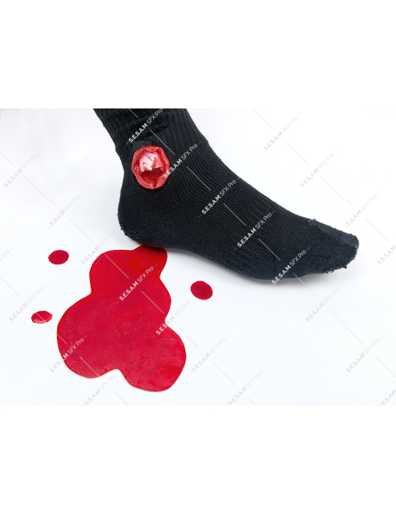 Fracture ouverte malléole