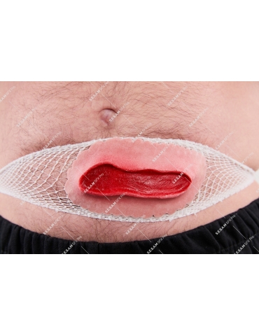 Coupure plaie abdominale 2