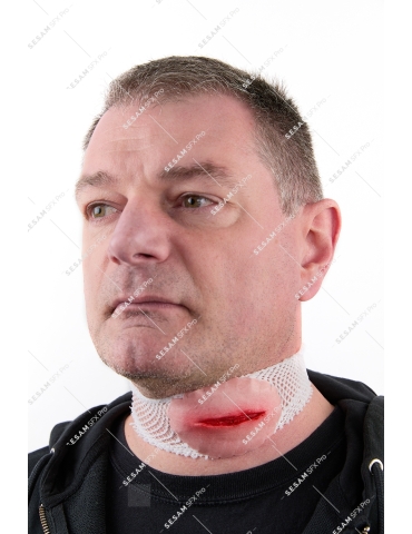 Plaie au cou carothide 2