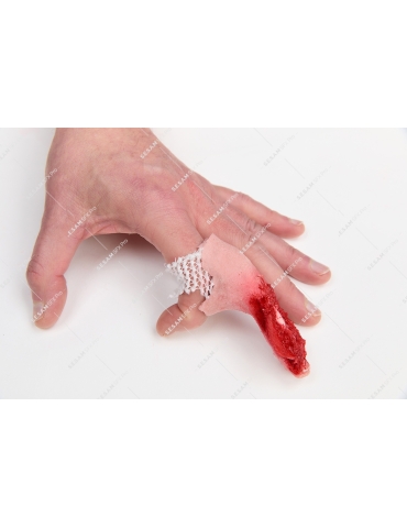 Doigt écrasé 2